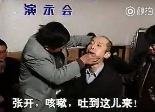 1994年气功大师帮葛大爷拔牙,葛优葛大爷拔牙