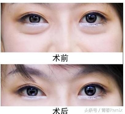 卧蚕要画多深,卧蚕要画很重吗