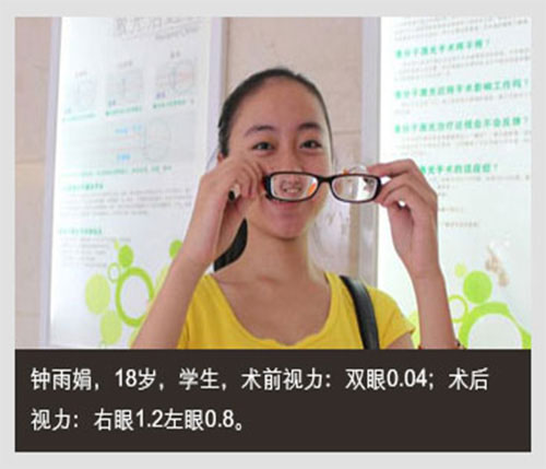 兰州普瑞做近视手术怎么样,兰州普瑞眼科做斜视怎么样