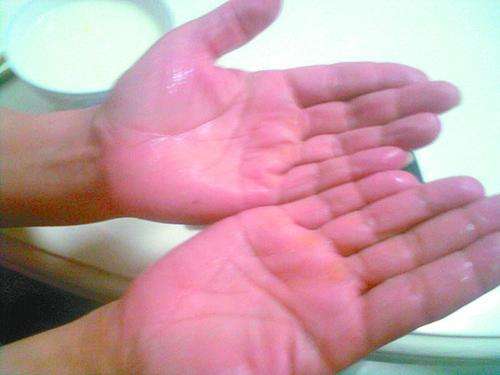 如何有效的抑制手掌出汗,手心容易出手汗怎么办