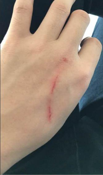 拉布拉多细小治疗成功率,拉布拉多治疗细小一天到七天变化