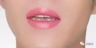 总被说牙齿黄,牙齿很黄是不是很讨人厌