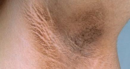 五个特征导致长寿与你无缘,身上这两处太圆基本与长寿无缘