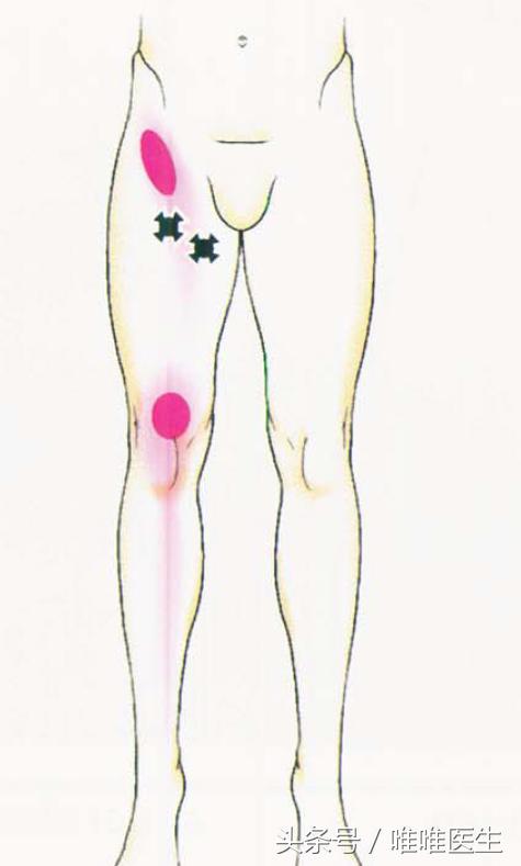 绝对干货膝盖损伤知识一网打尽,膝关节疼痛知识科普