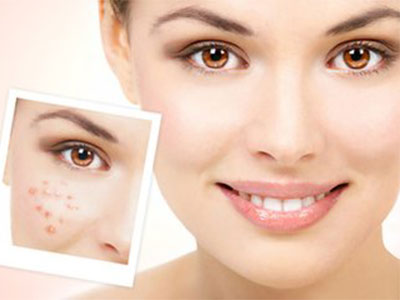 皮肤科医生推荐的淡化痘印方法,痘印顽固不化的原因