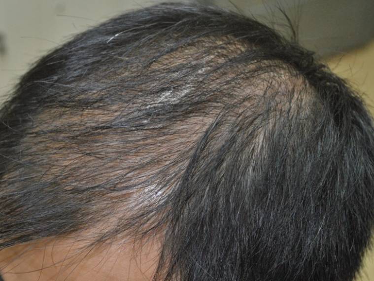 抽烟变丑如果戒了多久可以恢复,吸烟导致严重毁容的图片