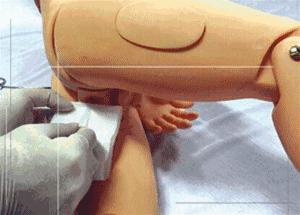 小孩便秘灌肠治疗视频,灌肠通便小孩