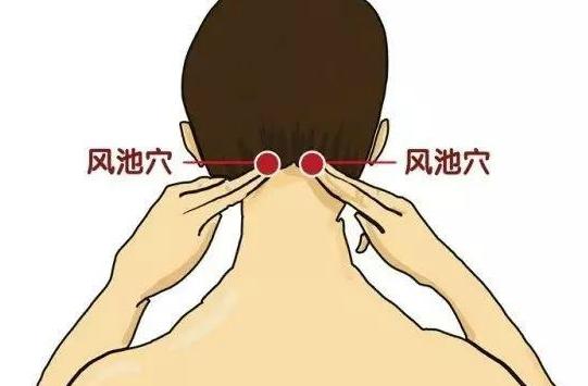 神经性头痛拔罐哪几个穴位,神经性头痛针灸穴位