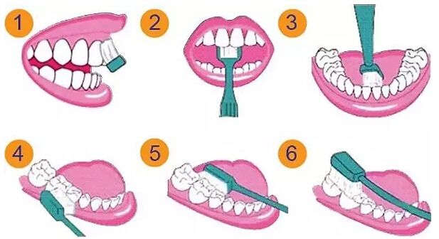 电动牙刷刷牙真的比一般牙刷好吗,刷牙是电动牙刷好还是普通的好