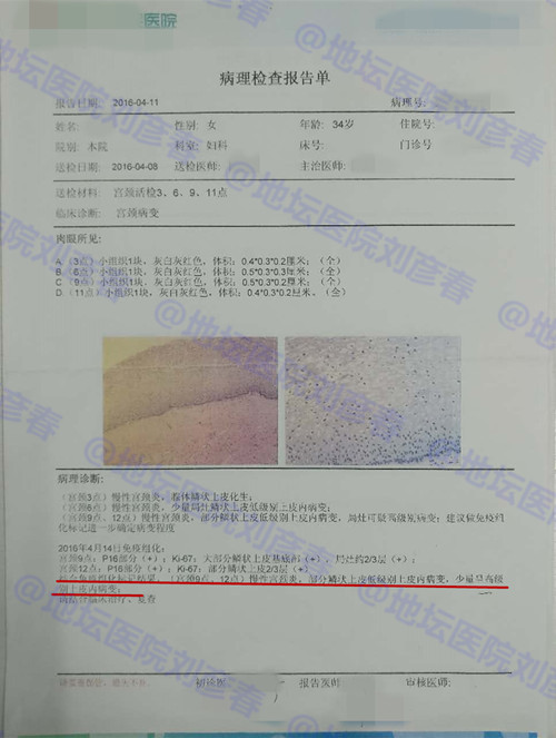宫颈锥切后边缘还是cin1怎么治疗,宫颈leep锥切术后hpv会转阴性吗