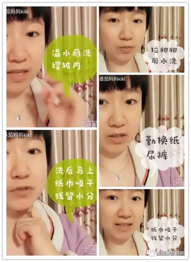 婴儿淹脖子发红怎么处理,宝宝淹脖子和红屁屁用什么产品