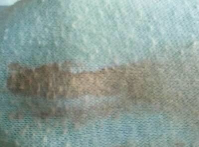 年轻准妈妈怀孕5个月流产得知原因医生怒斥：就不能忍忍！