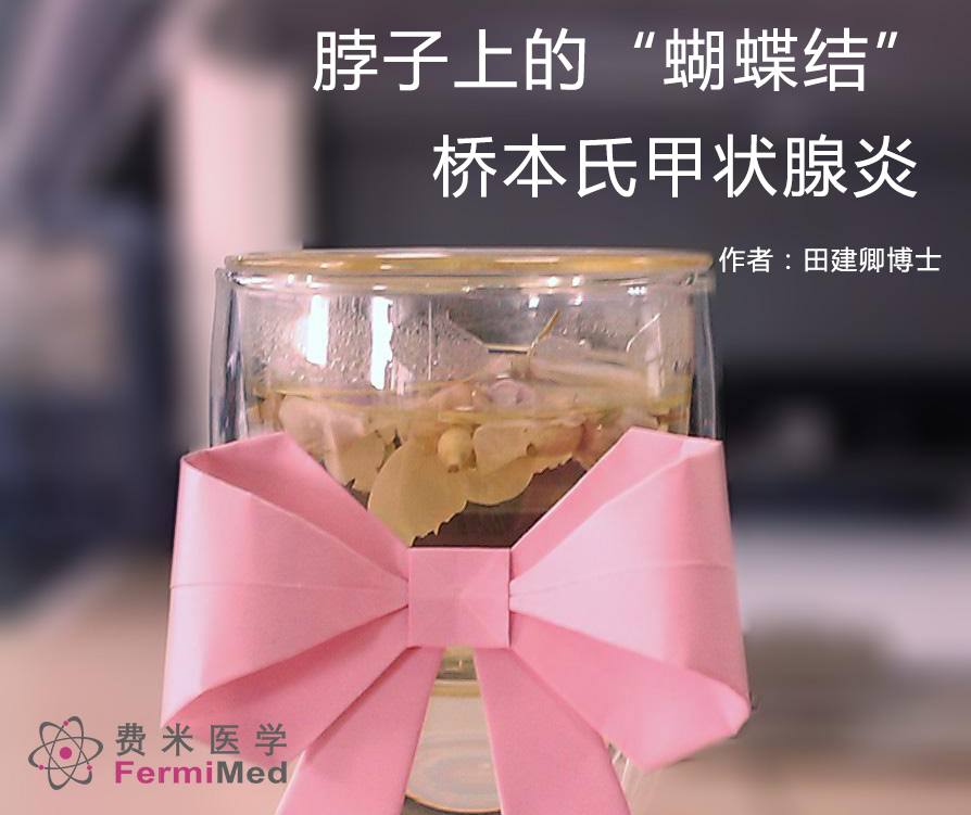 桥本氏甲状腺炎脖子上有包,桥本氏甲状腺炎加淋巴结