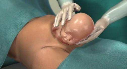 给孩子看的剖腹产手术全部流程,剖腹产手术最详细的介绍