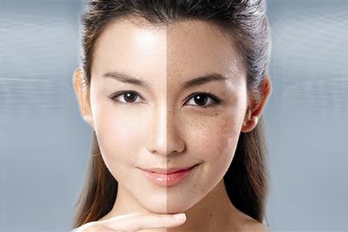 脸涂抹vc能预防妊娠斑吗,孕妇怎么预防妊娠斑