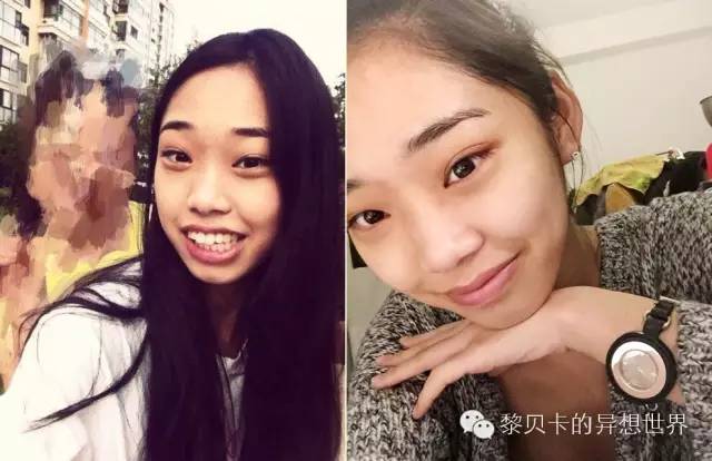 她们说||那些年整牙吞下的血和泪,终于换来最开怀的大笑