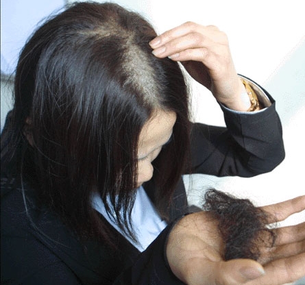 头发稀疏、频发掉发怎么回事？