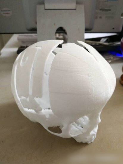 孩子个头偏小看医生有没有用,给宝宝检查头部必须去儿童医院吗