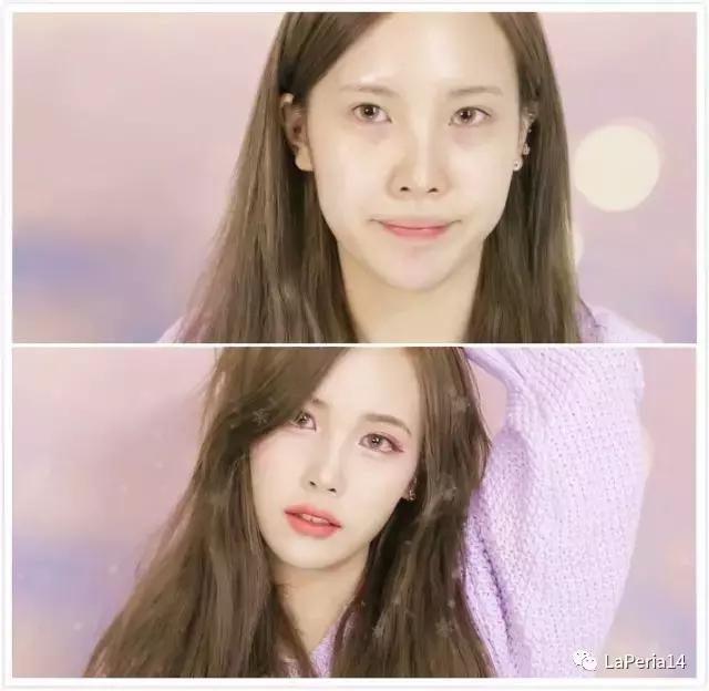 骨性方脸怎么瘦脸,方脸怎么改善脸型整骨