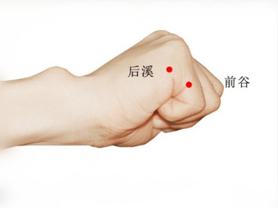 风寒湿型颈椎病针刺穴位,颈椎病风寒湿痹经络受阻