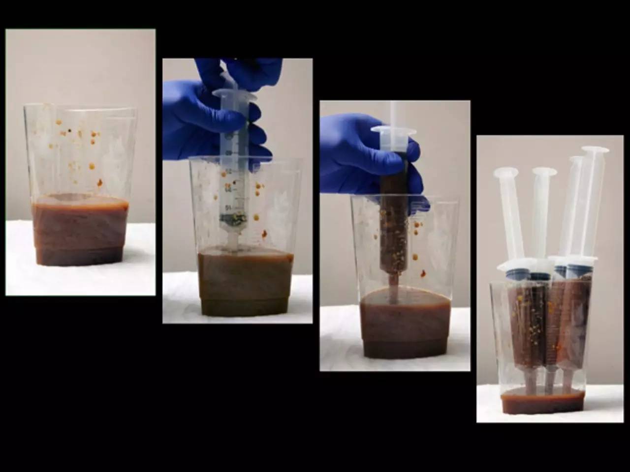 你狠心冲掉的便便,正成为许多肠胃病人的救星