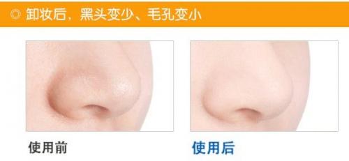 不同肤质如何挑选适合的卸妆产品,卸妆用什么卸妆产品比较好