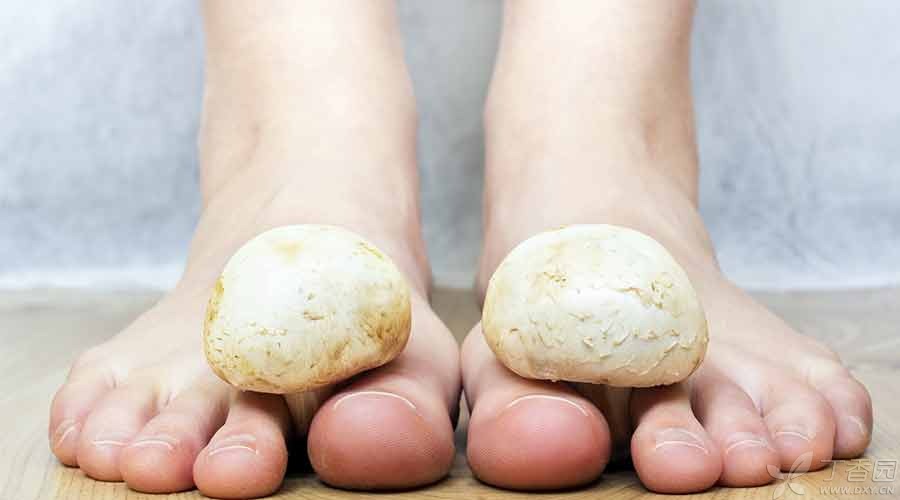 脚气问题看这里,揭秘脚气患者的认识误区