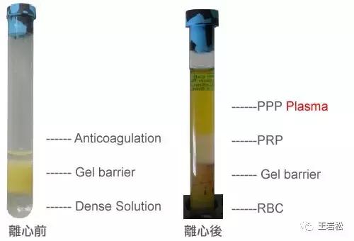 骨折术后怎么长得快,骨折为什么长得那么慢