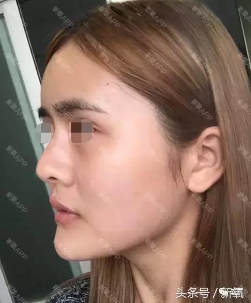 杨紫瘦了腿显得不纤细,杨紫变美之路脸怎么瘦的