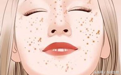 女性脸上暗黄有斑中药调理喝什么,35岁女性脸上长斑是什么原因