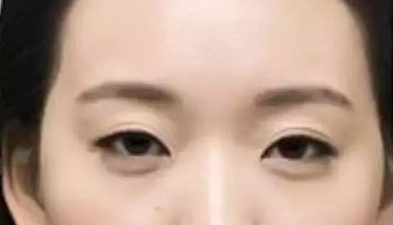 美瞳线和眼线哪个更漂亮一些,美瞳线加宽和画眼线的区别