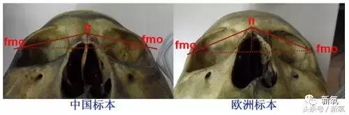 杨紫微整前后容颜对比,杨紫瘦了吗