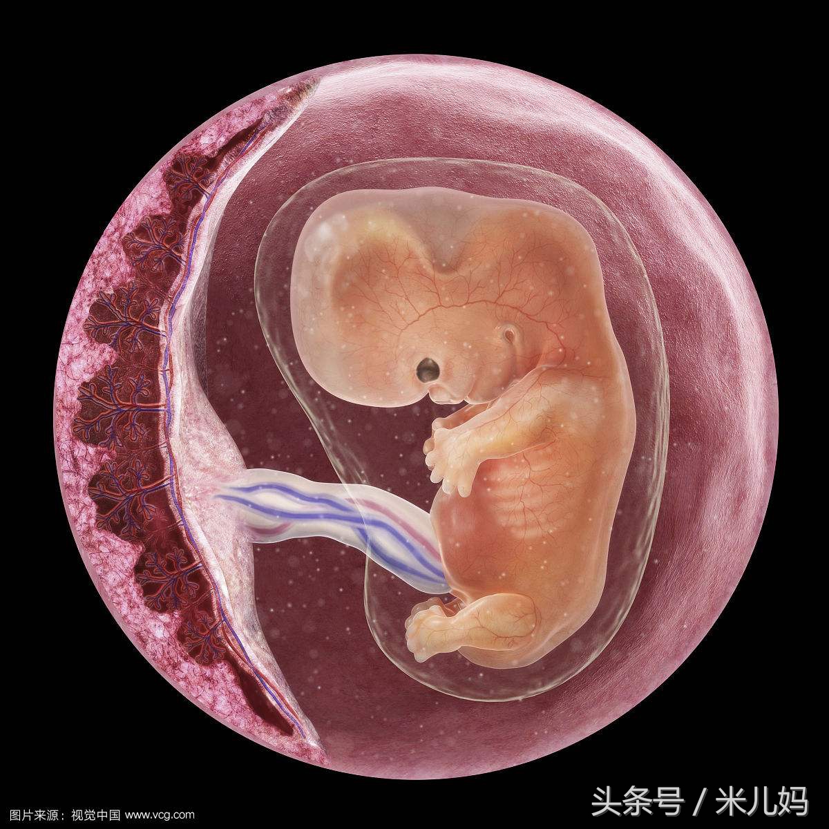 女孩医院做完流产，回家的路上大出血，孩子竟然还在肚子里