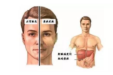 脸色暗沉发黄怎样才能有效的调理,女性脸色暗沉发黄无光泽如何调理