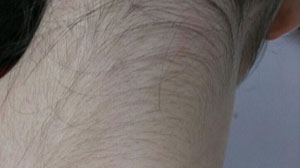 神奇脱毛露脱毛显奇功如果你有讨厌的体毛快来试用吧