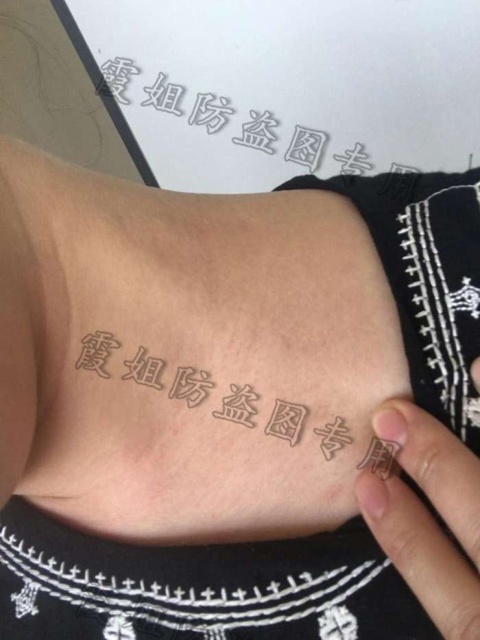 扁平疣|快去点掉你的扁平疣,别传染给我