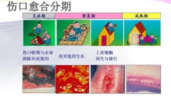术后忌口?别再被“发物”吓到了