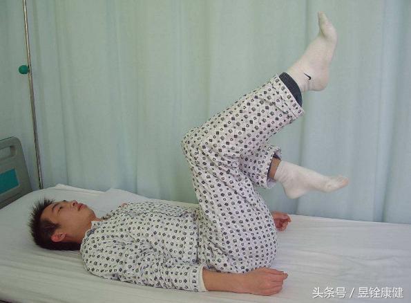 腰椎间盘突出症完全康复不是梦！早诊断、早治疗！