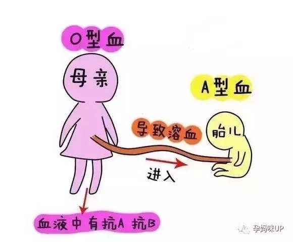 侯佩岑小儿子溶血症好了吗,侯佩岑孩子溶血症