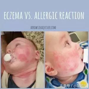 可以超过6个月再加辅食吗,六个月后还没添加辅食会怎么样