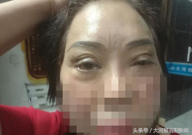 美容变毁容,美容变毁容女子要求全额退款遭拒