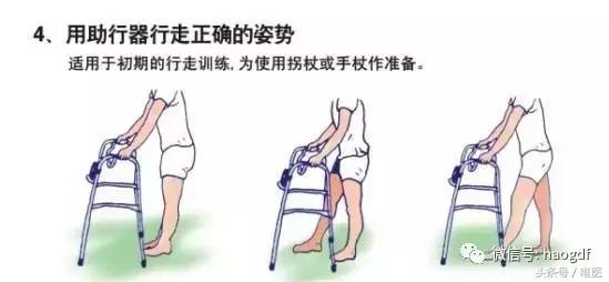 髋关节置换后护理康复训练视频,髋关节置换术后康复护理app