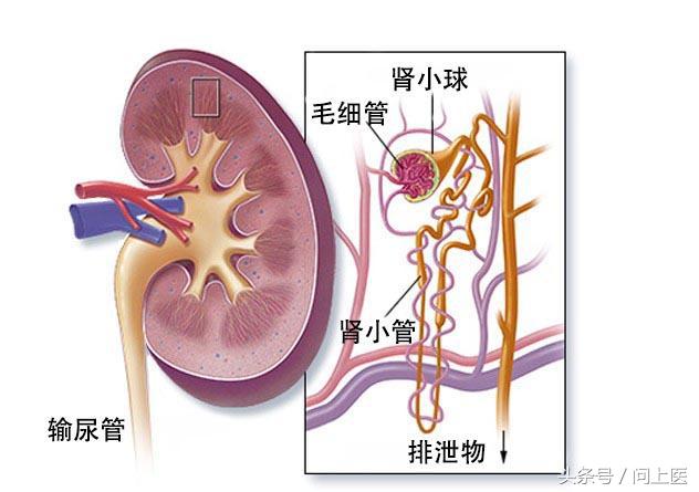 尿蛋白高肾病综合征最快解决方法,高血压肾病尿蛋白3+会出现水肿吗