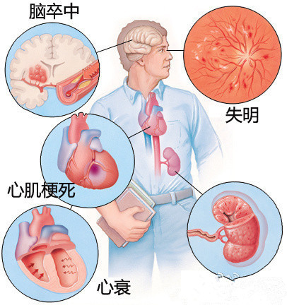 普利和沙坦首选哪个视频,普利和沙坦哪个对肾更好