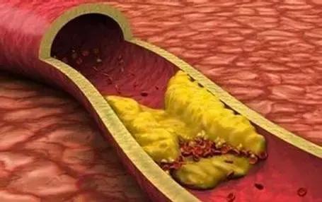 白发突然增多小心硬化,白发变黑发吃什么维生素