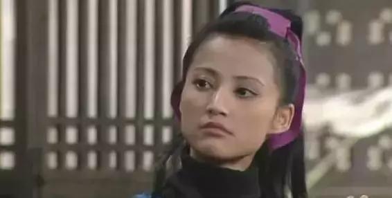 张歆艺打了玻尿酸后的样子,张歆艺下巴打了玻尿酸