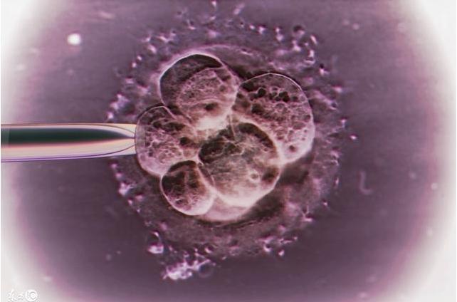 35岁女子做试管婴儿15年后后悔,女性做试管婴儿痛苦视频