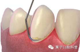 月子牙刷有必要买吗,月子牙刷到底该不该买