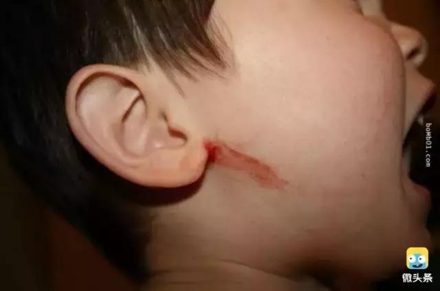 被雷劈是种什么样的体验？看完简直身受同感