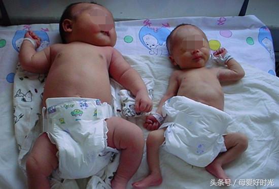 600多斤的孕妇生产，婴儿出生后让助产医生难以置信！